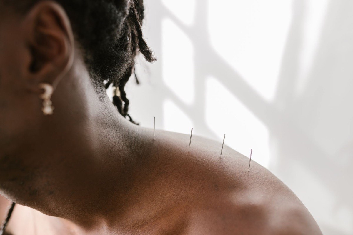 Dry Needling for Shoulder Pain in Reno: Releasing the Trigger Points Behind It